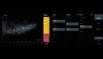 The Dual Screen User Interface